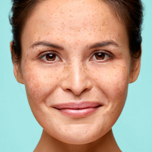 Biodermal Hydraplus dag - Gel crème vochtarme huid met Hyaluronzuur & Glycerine - 50ml